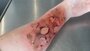 opsite wondspray_